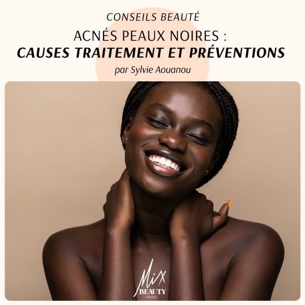 Acnés peaux noires : causes traitement et préventions